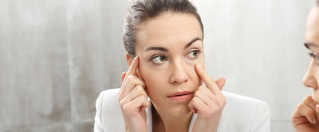 Μαύροι κύκλοι κάτω από τα μάτια – τι βοηθάει;